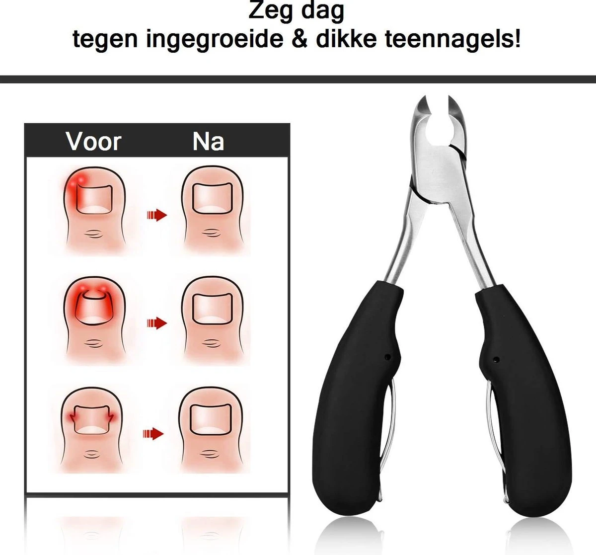 Merkloos Nageltang Met Gebogen Bek + Vijl - Nagelknipper Set - Pedicure Set 6 Merkloos Nageltang Met Gebogen Bek + Vijl - Nagelknipper Set - Pedicure Set - Afbeelding 6