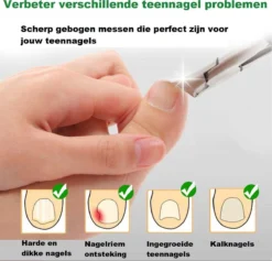 Merkloos Nageltang Met Gebogen Bek + Vijl - Nagelknipper Set - Pedicure Set 11 Merkloos Nageltang Met Gebogen Bek + Vijl - Nagelknipper Set - Pedicure Set -Cosmeticawinkel 1200x1153 6