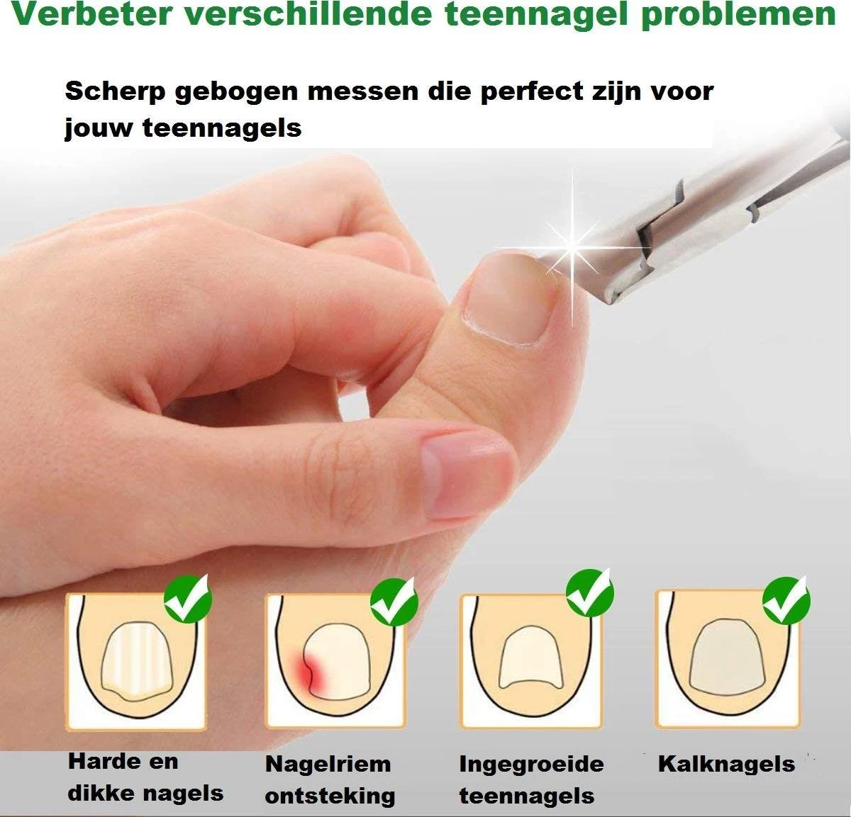 Merkloos Nageltang Met Gebogen Bek + Vijl - Nagelknipper Set - Pedicure Set 5 Merkloos Nageltang Met Gebogen Bek + Vijl - Nagelknipper Set - Pedicure Set - Afbeelding 5
