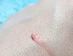 Biodermal Sun Lipbalm SPF25 - Tube 12 Ml - Natural Pink - Lippenbalsem -Cosmeticawinkel 1200x927 1