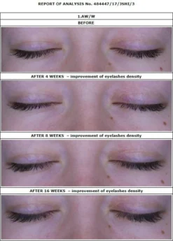 Oceanic Long4Lashes Gold Eyelash Wimpernserum 4 Ml -Cosmeticawinkel 859x1200 1